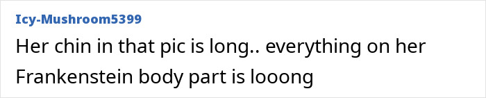 Comment text criticizing Kylie Jenner&rsquo;s chin and plastic surgery scar, highlighting a long chin and body part.