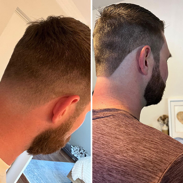 Side-by-side photos showing a man's haircut before and after a salon glow-up with uneven and patchy results.