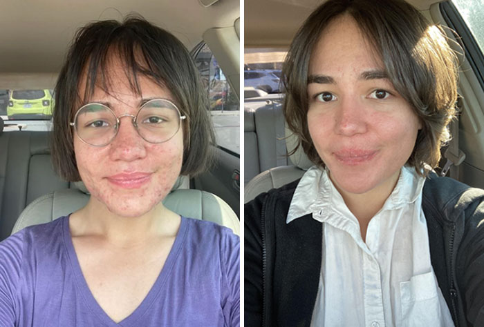 Before and after salon glow-up showing a woman with short hair and glasses, highlighting dramatic transformation results.