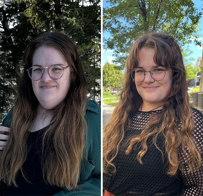 Before-and-after photos of a woman showcasing natural facelift results with subtle facial and hairstyle changes outdoors.