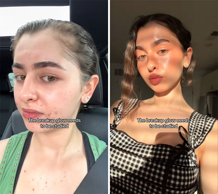 Side-by-side comparison showing the breakup glow-up effect with noticeable skin and confidence improvement.