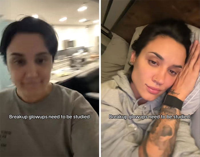 Before and after breakup glow-up comparison of a woman showing the noticeable breakup glow-up effect transformation.