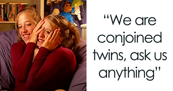 Conjoined Twins Answer 24 People’s Most Interesting And Burning Questions