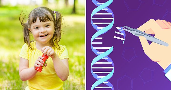 Ethical Concerns Rise After Scientists Use Gene Editing To Erase Down Syndrome-Causing Chromosome