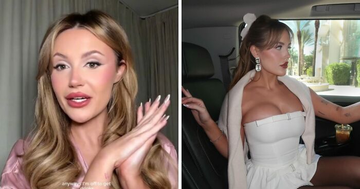 Woman Horrified After Botching Her Plastic Surgery By Ignoring Recovery Instructions