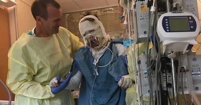 Woman Burned In Gas Station Explosion Stuns The Internet With Transformation 6 Years Later