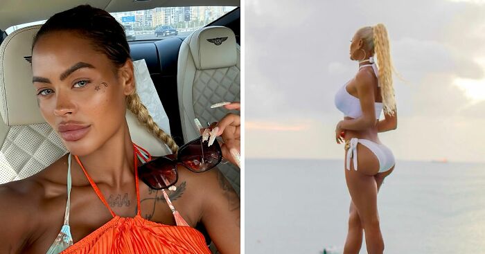 Woman Travels 5,000 Miles For Butt Surgery, Only For Implants To Fall Out At The Gym