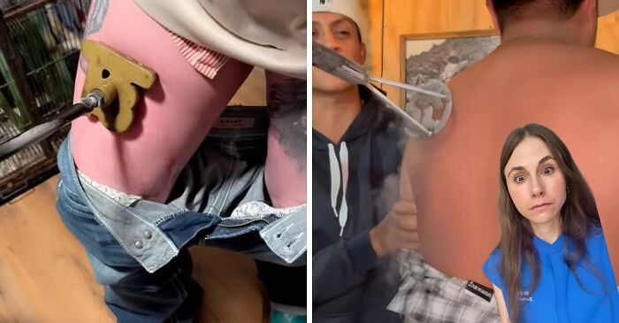 Doctors Warn About Trendy “Freeze” Branding Tattoo Alternative That Puts People “At Risk”