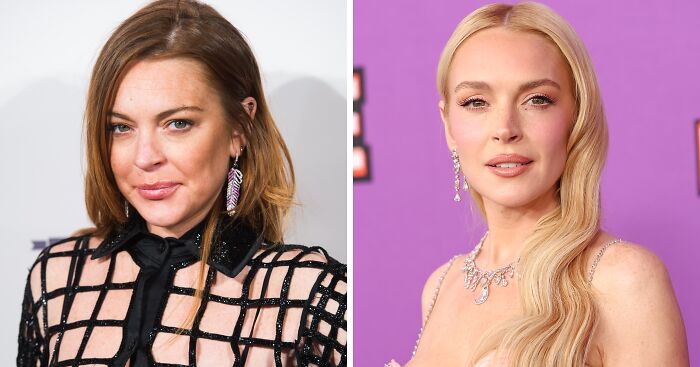 “10 Years Younger”: Experts Weigh In On Lindsay Lohan’s Fresh-Faced Glow Amid Plastic Surgery Drama