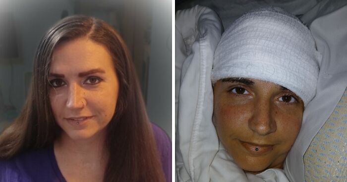 Paralyzed Woman Stuns Internet By Showing What Elon Musk’s Neuralink Brain Chip Can Do