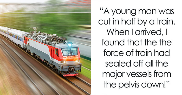 “How Are They Still Alive?”: Doctors Share 50 Stories Of Patients That Survived Against All Odds