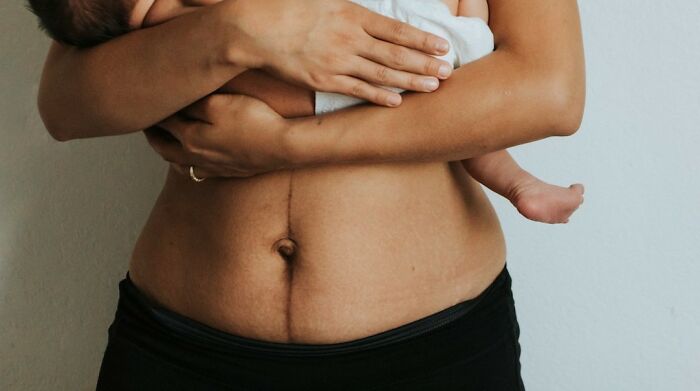 "Ugh He's A Ginger": 50 Women Reveal Disgusting And Horrible Things Said To Them After Birth