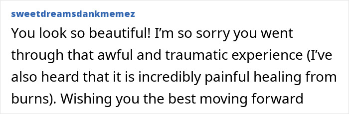 Woman burned in gas station explosion showing inspiring transformation six years after the accident, stunning the internet. - 30