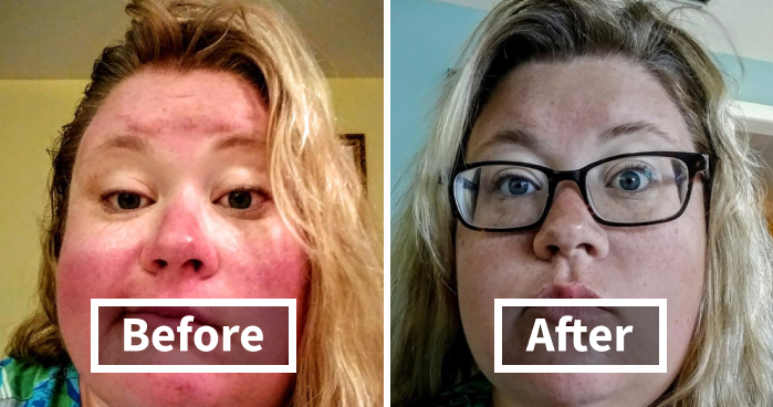 We’re All Friends Here, So Let’s Talk About These 23 Cringe-Worthy Problem Solvers