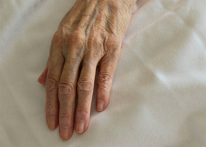 Elderly hand showing signs of aging on a white fabric surface, highlighting doctors' insights on death machines. - 4