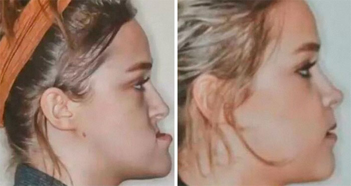 “The Eyes After Death”: 50 Of The Most Bizarrely Fascinating Photos Shared By Medical Professionals (New Pics)