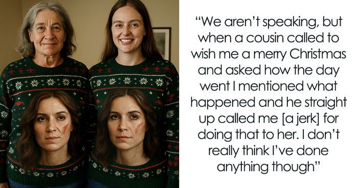 GF With Facial Scar Is The Butt Of BF’s Family’s Joke, Storms Out Of Christmas Gathering