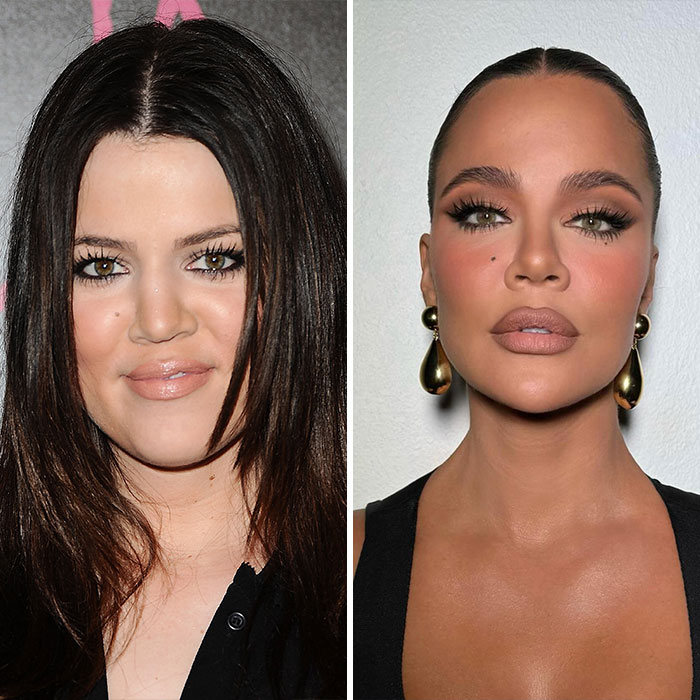 Khlo&eacute; Kardashian shown before and after cosmetic procedures with makeup and styled hair in each portrait.