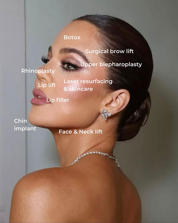Khlo&eacute; Kardashian's cosmetic procedures labeled on her face including Botox, rhinoplasty, and face and neck lift.