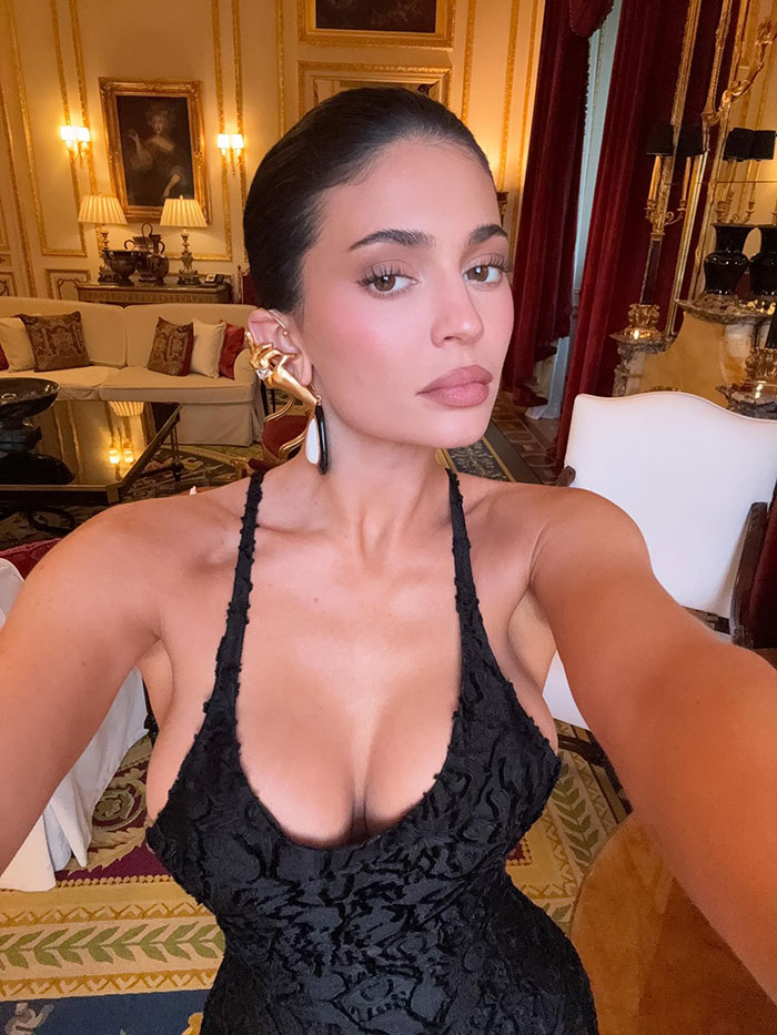 Kylie Jenner poses in elegant black dress showcasing a subtle plastic surgery scar in a luxurious, ornate room setting.