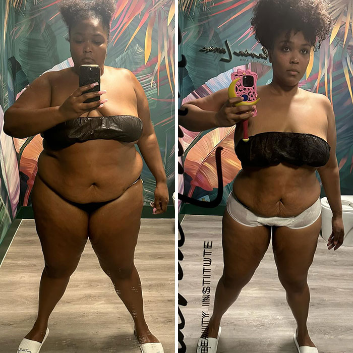 Lizzo Strips Down To Show Drastic Weight Loss, Comes Clean About How Exactly She Dropped Pounds