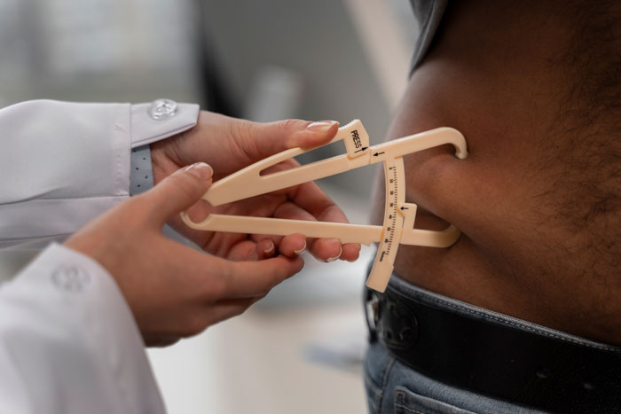 Healthcare professional measuring body fat on obese patient’s abdomen using caliper in medical clinic setting. - 4