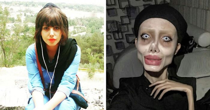 20 Extreme Plastic Surgery Journeys Of Normal People That Led To Fame