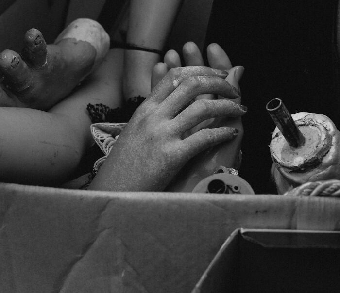 Box filled with creepy mannequin hands and feet, illustrating unusual items found by medical professionals.