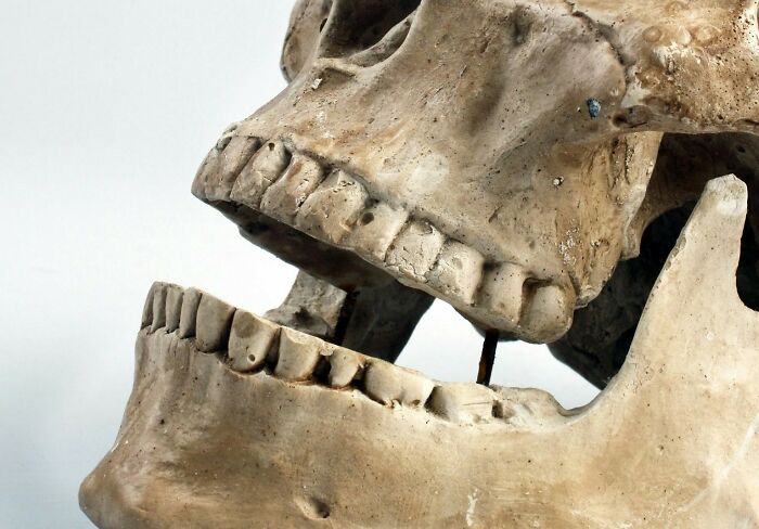 Close-up of a human skull used by scientists studying bodies donated for science and medical research purposes.
