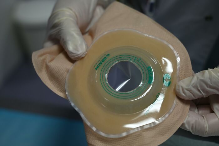 Close-up of gloved hands holding a medical ostomy bag, showing details for truckers share craziest things seen context. - 23