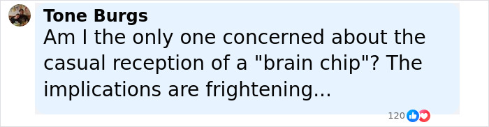 Comment by Tone Burgs expressing concern about the casual reception and frightening implications of Elon Musk's Neuralink brain chip.