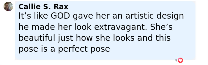 Winnie Harlow stunning in a bikini, showcasing her unique beauty and artistic skin design for her 31st birthday celebration. - 16