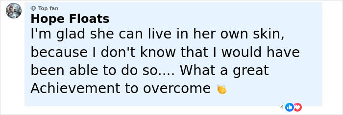Comment praising Winnie Harlow for living confidently in her own skin and overcoming challenges, highlighting achievement. - 21