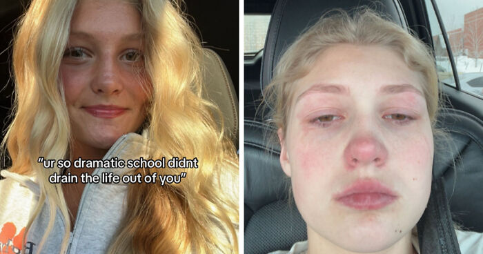 Side-by-side before and after photos of a woman showing changes after life happened to her.