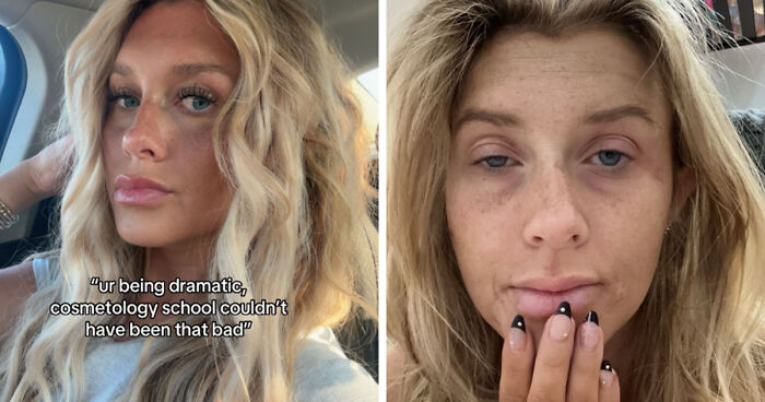 Side-by-side before and after photos showing the real impact of life changes on a woman's appearance.