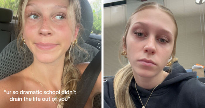 Side-by-side before and after photos of a young woman showing change over time life happened to them.