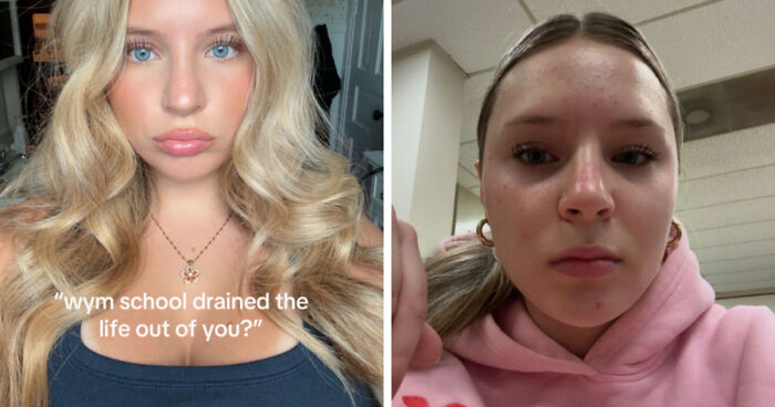 Side-by-side before and after photos showing the impact of life on a young woman’s appearance in relatable life happened pics.