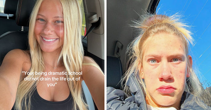 Folks Share 25 Pics Of Before And After “Life Happened” To Them