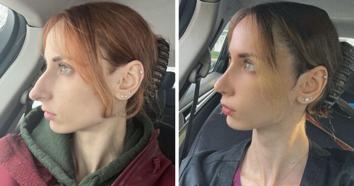 50 People Who Look Unrecognizable After Plastic Surgery