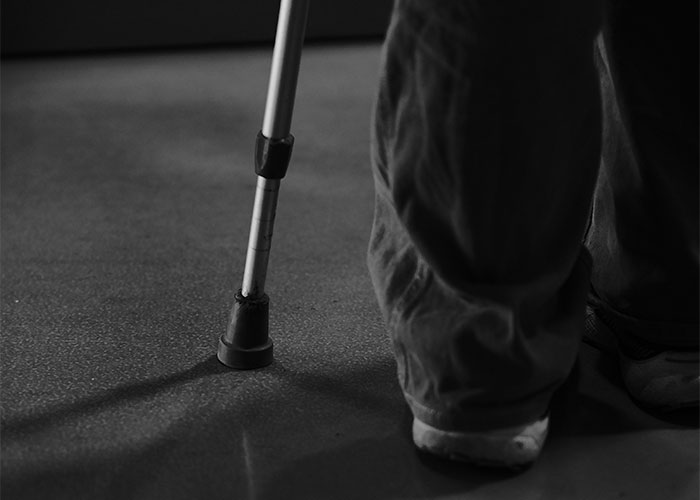 Close-up of a person’s leg with a crutch, illustrating strange things private investigators discovered on the job. - 16