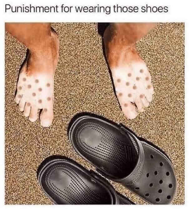 Sunburned feet with sandal-shaped marks on sand, illustrating a funny summer meme about outdoor struggles.
