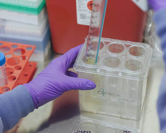 Scientist wearing purple gloves using a pipette with test tubes in a lab focused on gene editing research.