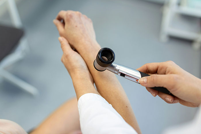 Doctor examining patient’s skin with dermatoscope, highlighting serious medical conditions often dismissed and delayed diagnosis.