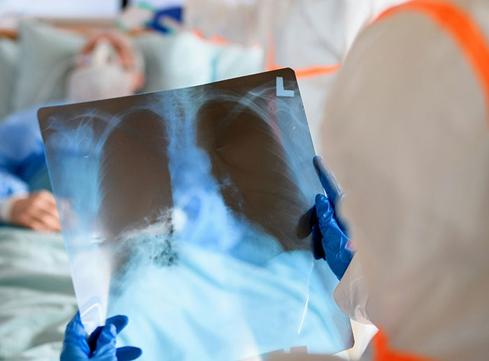 Healthcare professional in protective gear examining a chest X-ray highlighting serious medical conditions diagnosis delay.