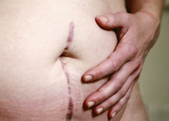 "Surgeons: What Weird Facts Do You Know About The Human Body That You Don't Share With Anybody?"