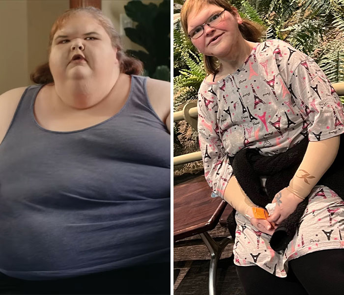 Tammy Slaton from 1000-Lb Sisters shows transformation after skin removal surgery, looking barely recognizable in before and after photos.