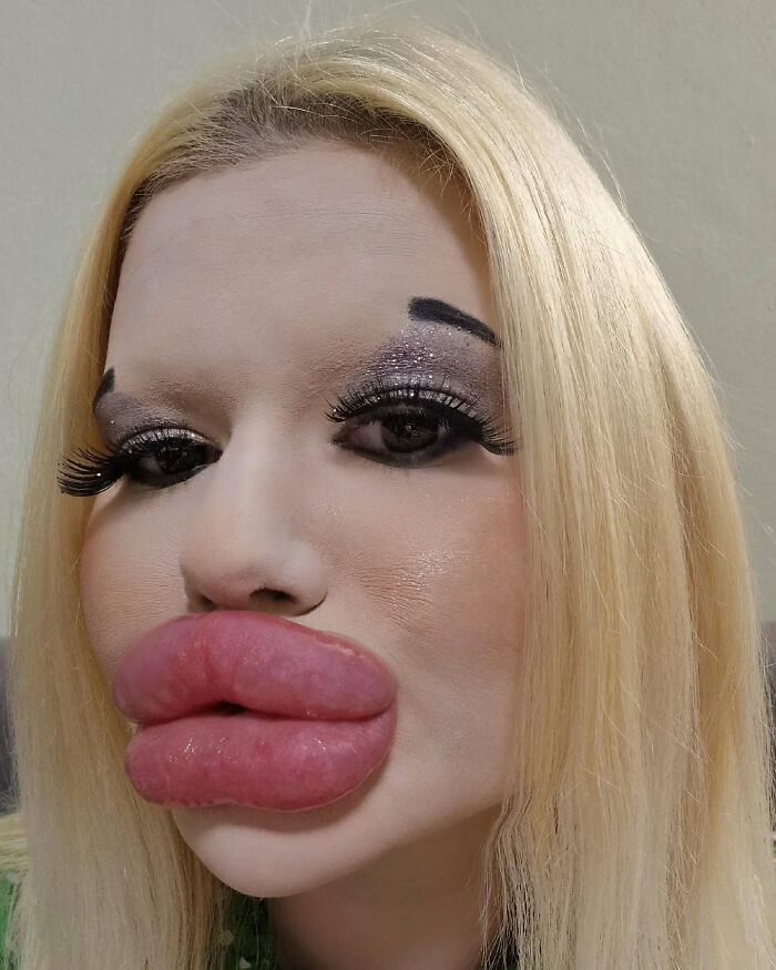 Woman with world's biggest lips showing extreme lip enlargement and makeup with blonde hair in close-up portrait.