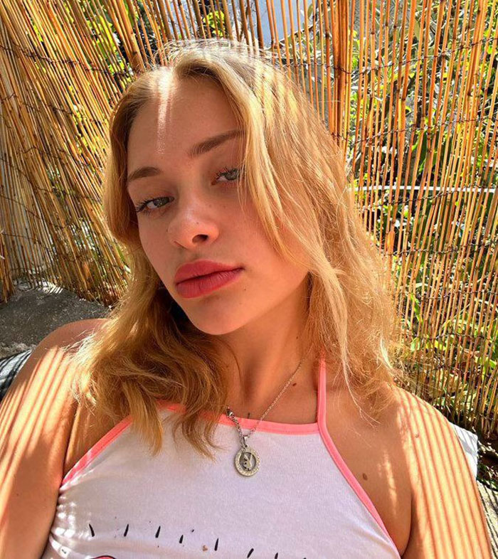 Young female model with blonde hair posing outdoors with bamboo fence background, related to broken limbs and spine case in Dubai. - 1