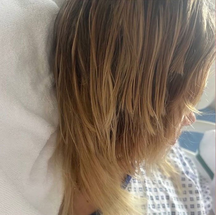 Side view of injured Ukrainian model with wet hair, lying on hospital bed after Dubai roadside attack. - 8