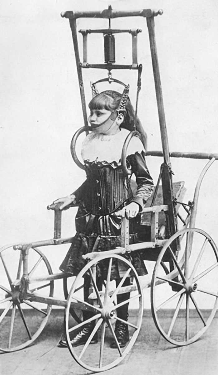 Child using an unsettling medical device from the past designed for head and neck support in early medicine.